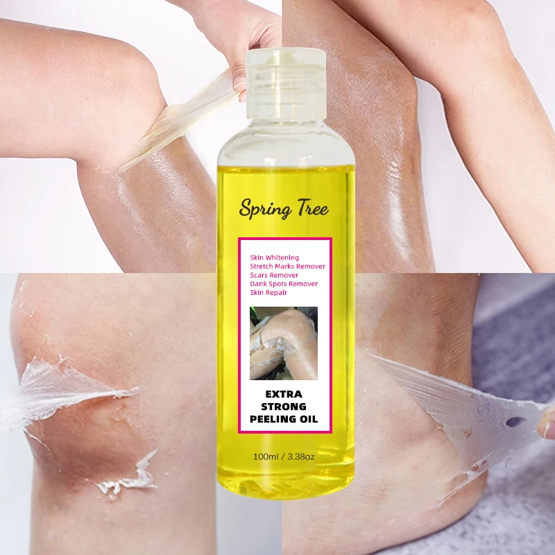 Super Strength Yellow Peeling Oil whitening Elbows Knees Hands Melanin Bleaching Dark Skin Strong Peeling Oil