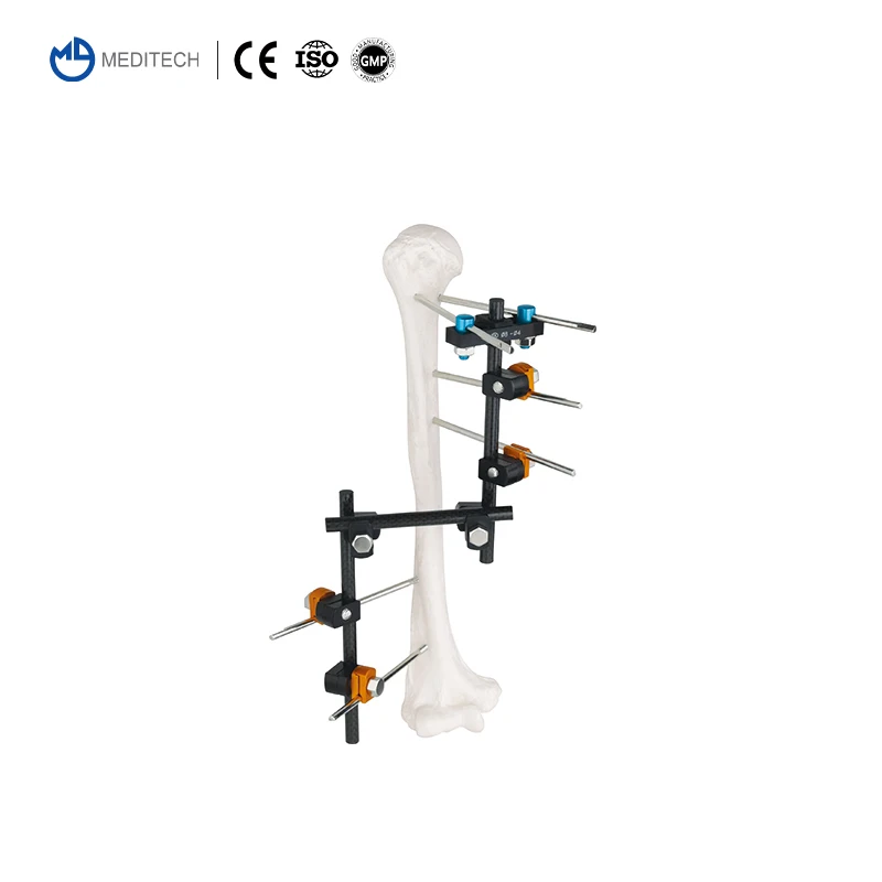 MEDITECH Factory Trauma Orthopedic External Fixation Orthopedic Implants Synthes External Fixator For Orthopedic Surgery