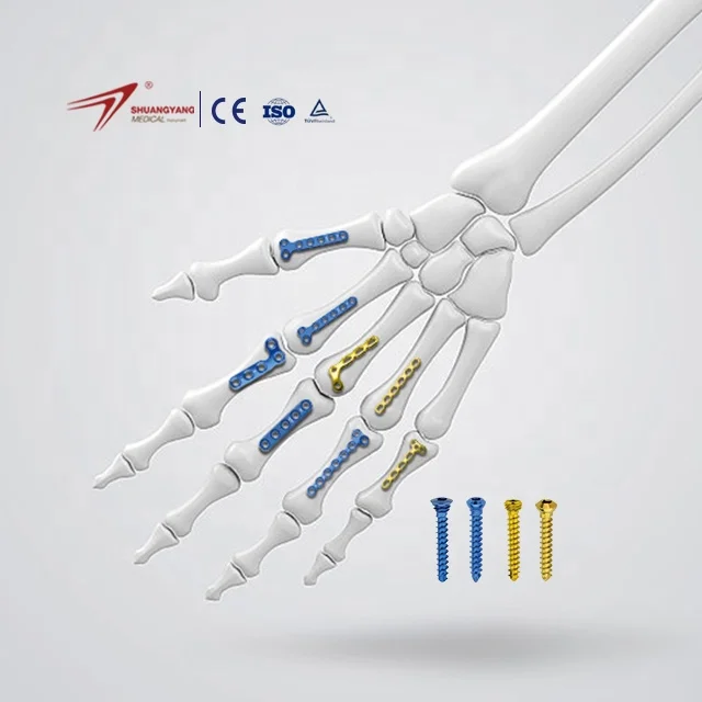 Factory Price Shuangyang Orthopedic Titanium Implants Mini Locking Fragment Plate Good Price Mini Finger And Foot Locking Plate