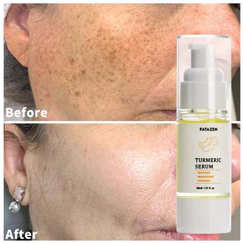 Private Label Organic Turmeric Natural Face Serum Anti Aging Dry Fine Lines Repair Damaged Skin Care Facial Vitamin C Serum