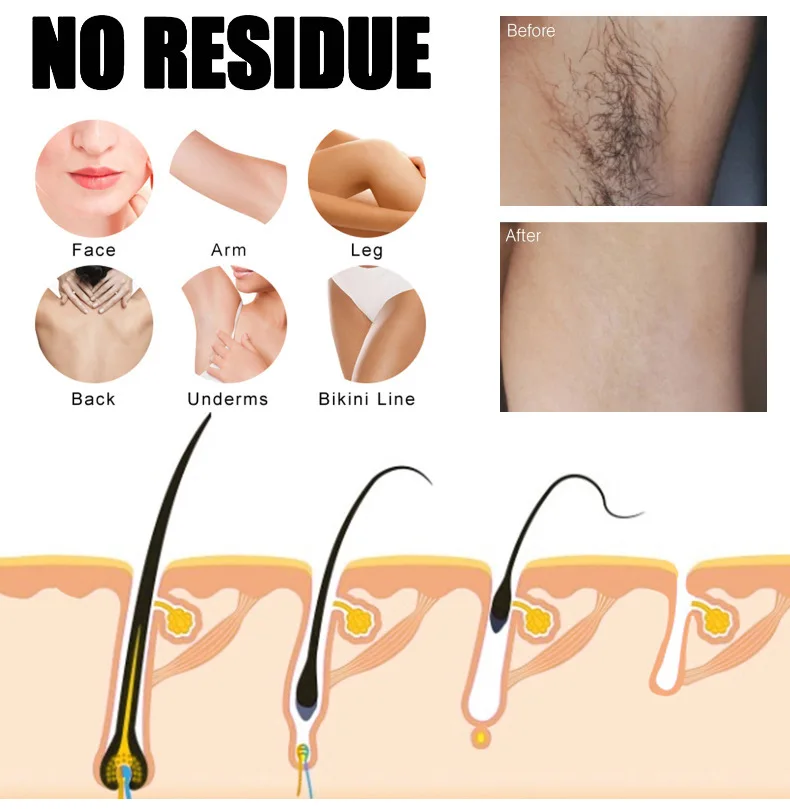 Best Selling Hair Removal Strips For Men and Women Body Unwanted Hair Magic One Second Quick Hair Removal Wax Strip Paper