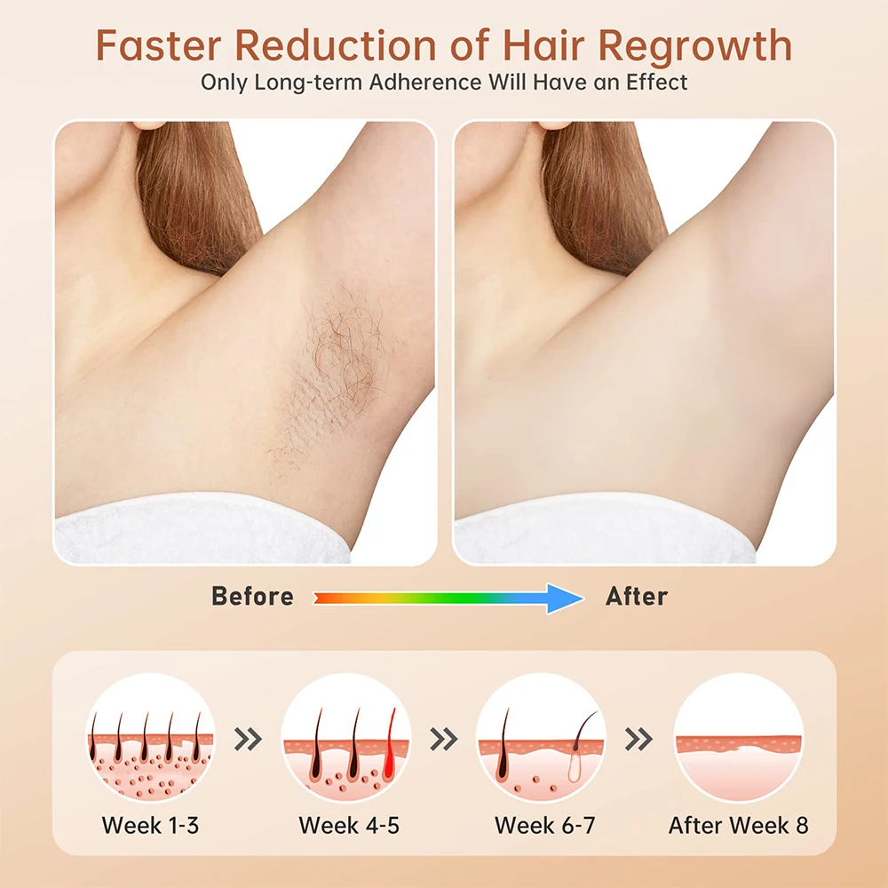 Women Shaver Hair Removal Customized logo Household Hair Removal Device Portable Laser Epilator Painless Permanent Hair Remover