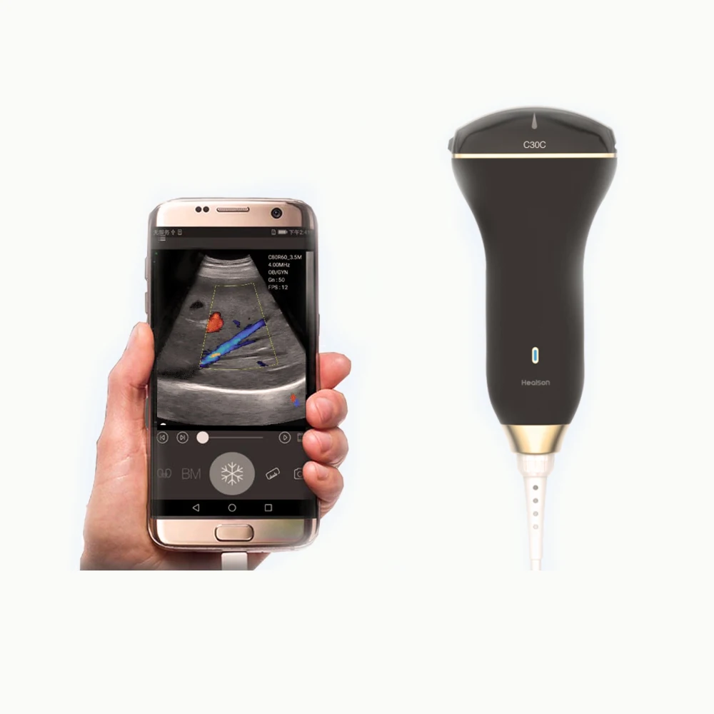 
 Ручной ультразвуковой допплер Healson C30 uprobe выпуклого цвета для смартфона  