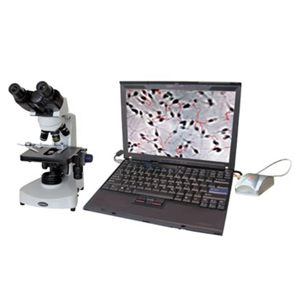 Vet Animal Cow Sperm Analyzer Count Microscope Portable Automated Dog Cattle Veterinary Semen Analyzer