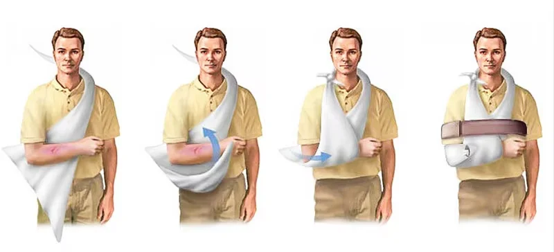 high quality Non-Woven Arm Sling Triangle Triangular Bandages