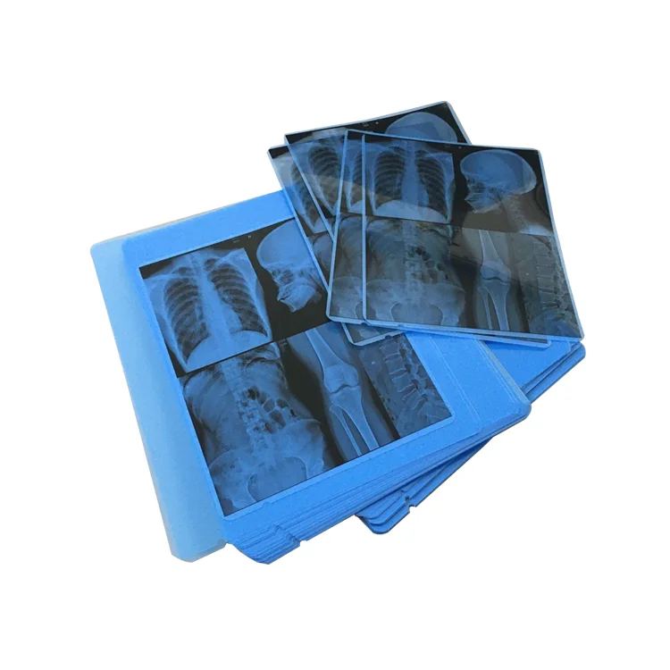 Nanjing Factory Wholesale Accurate And True Image Blue Dental X Ray Film For Kodak Printer
