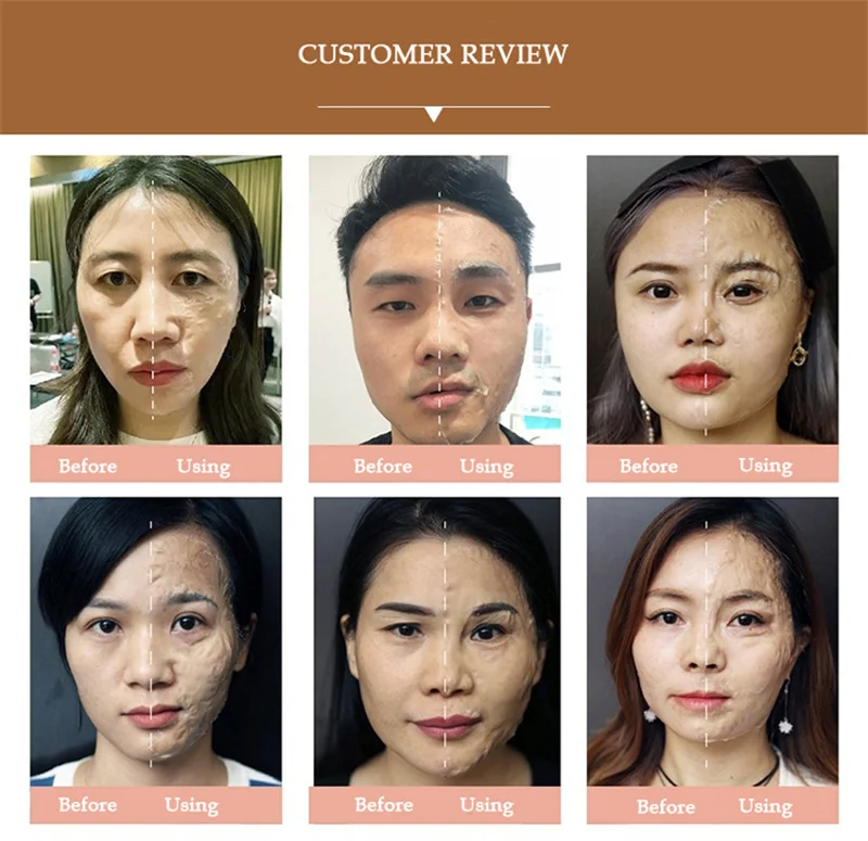ZS Korean Face Lifting Firming Enzyme Mask Age-Defying Enzyme Peeling Lyophilized Powder Tightening Face Sculpting Enzyme Mask
