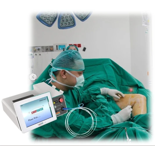 Endovascular diode laser ablation evlt 1470 endovenous laser for varicose veins device
