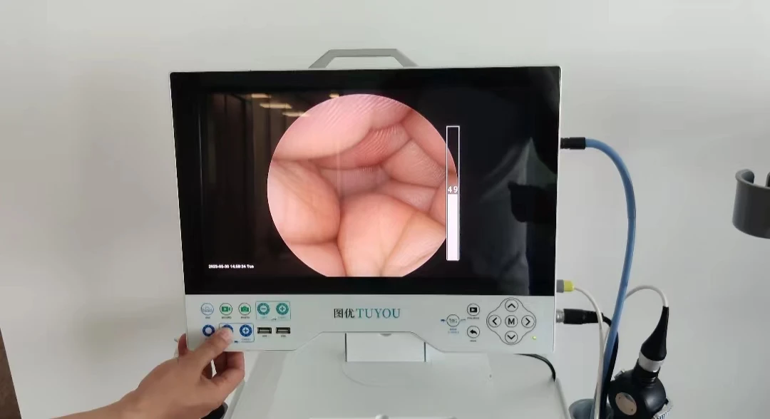 Laparoscopic Camera Hd Endoscope 4 in 1 Portable Endoscopic Camera Endoscope Camera System