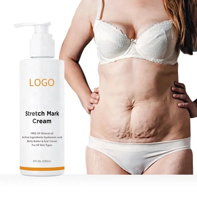 Stretch Mark Cream with Aloe Vtamn Olives Powerful stretch mark removal Natural organic skin stretch repair mark removal cream