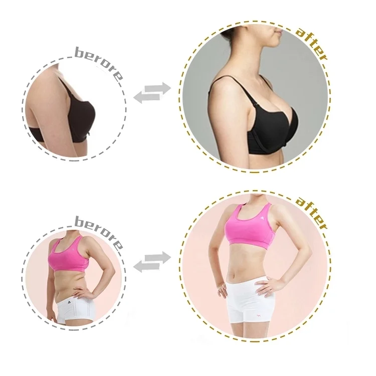 Electric Cupping Massager Vacuum Suction Cup Vacuum Butt Lifting Machine With Vacuum Roller Lymphatic Drainage