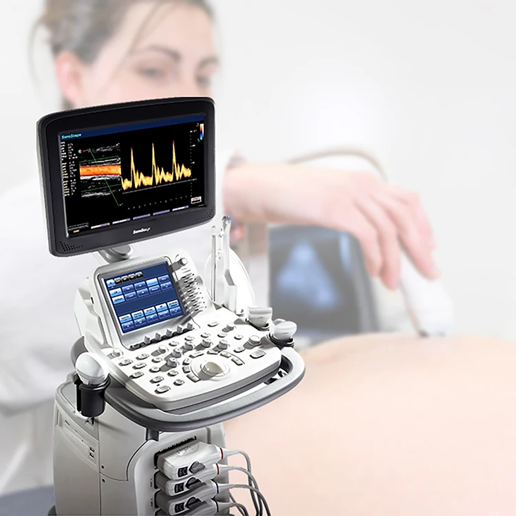 S20 Sonoscape Ultrasound s2