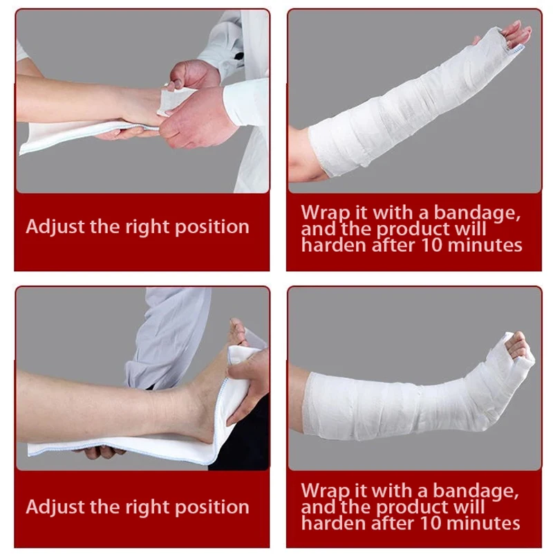 splint-2