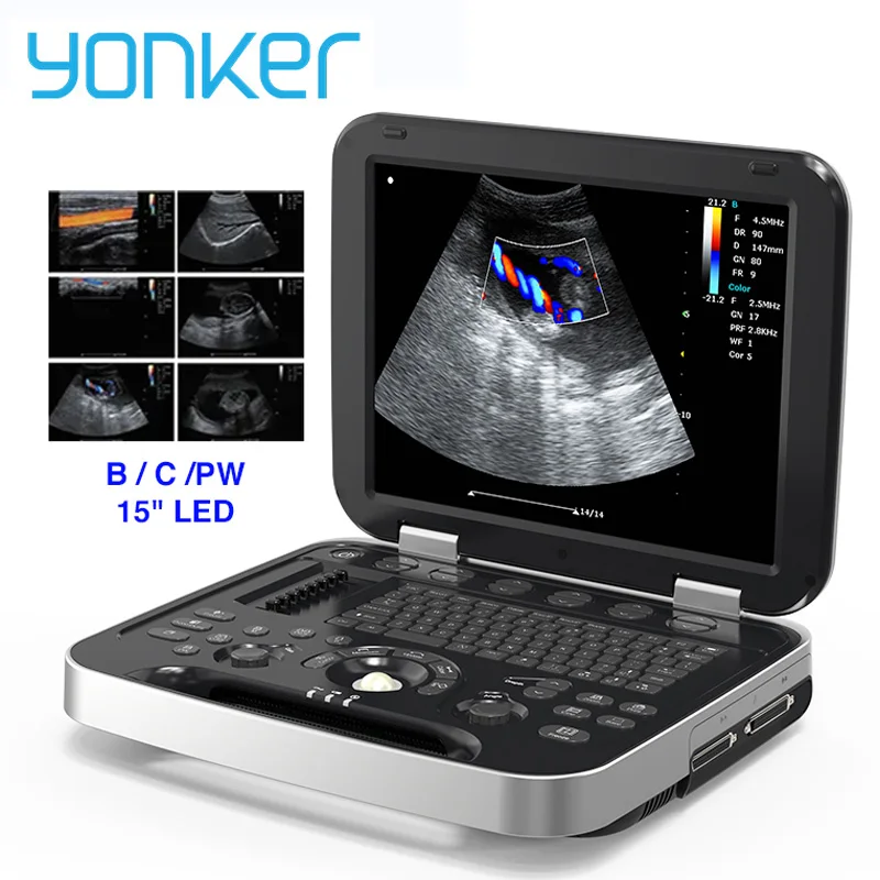 Yonker Medical Echo Echocardiography Cardiac laptop gynecological ultrasound machine Price Probe Ultrasonido Doppler Color