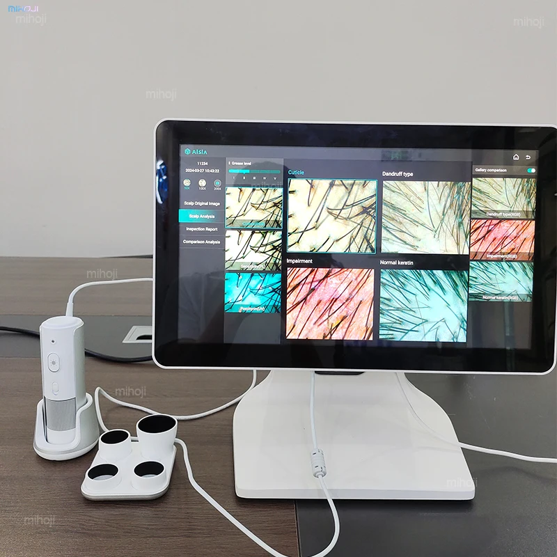 hair growth scalp and hair analysis machine professional scalp analysis