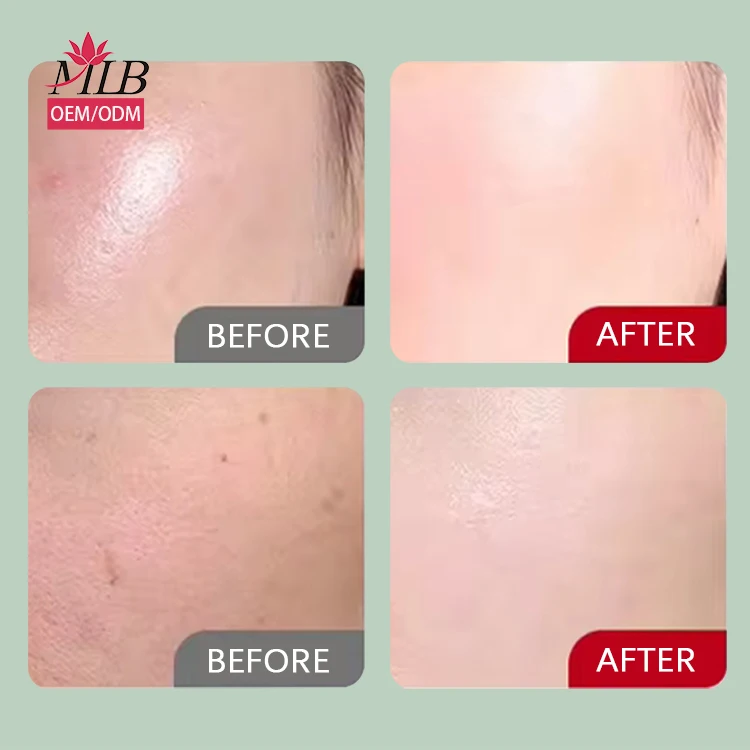 Manufacturer Custom Korea Skincare  Sheet Face Mask Moisturizing Whitening Natural Organic Aloe Vare Facial Mask