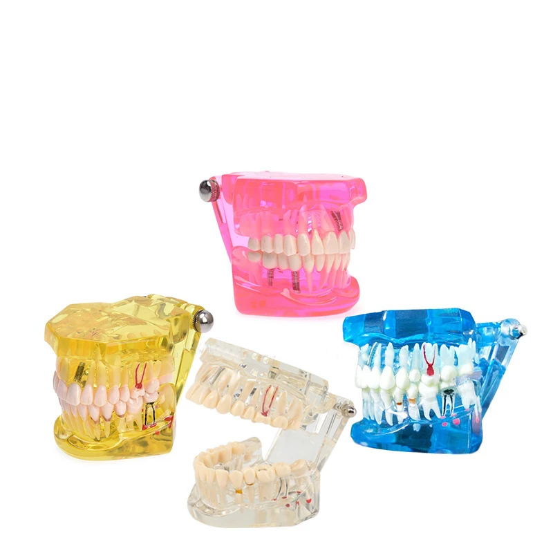 High quality lab typodont dental model practice dental implant model