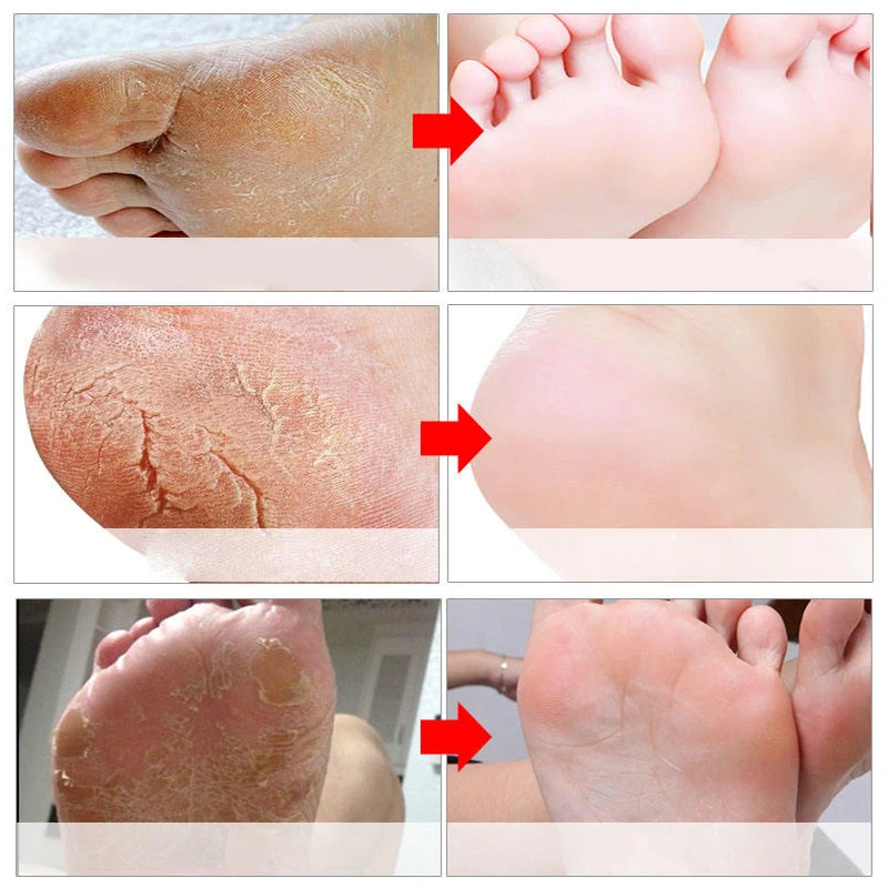Oem Wholesale Ypeeling And Lavender Vc Exfoliating Foot Mask Spa Pedicure Socks