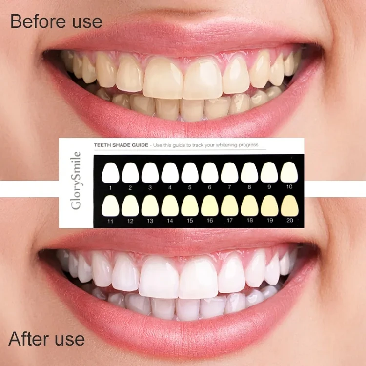 Sensitive Teeth Whitener 16 LED Light Dental Bleaching Teeth Whitening Kit