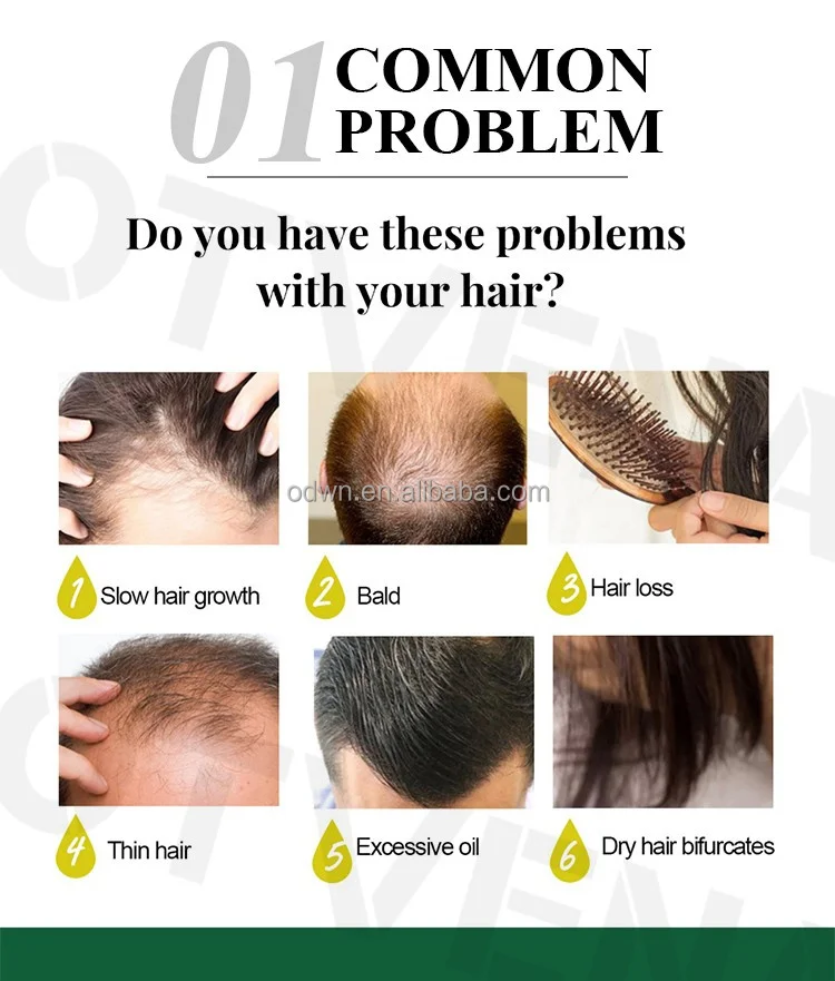 Private Label Organic Anti-Hair Loss Treatment Regrowth Black Seed Extract Thicken Hair Growth Oil Serum Spray