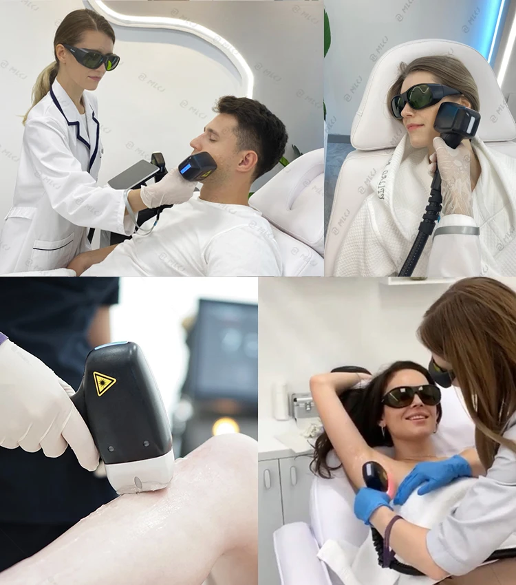 808 Diode Laser Hair Removal Machine 755nm/1064nm/808nm Diode Laser Germany Stationary Ice Titanium 4000W