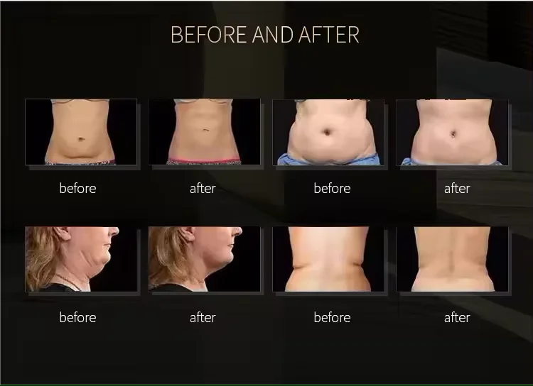 Portable 80K cavit RF 7 in 1 Diode Lipo Vacuum Cavit System Machine