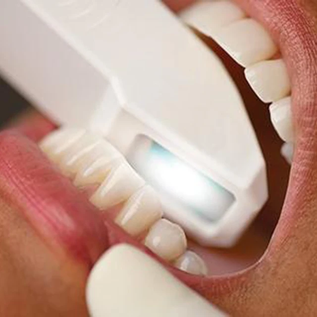 scanner 3d dental dental x-ray machine dental x-ray portable