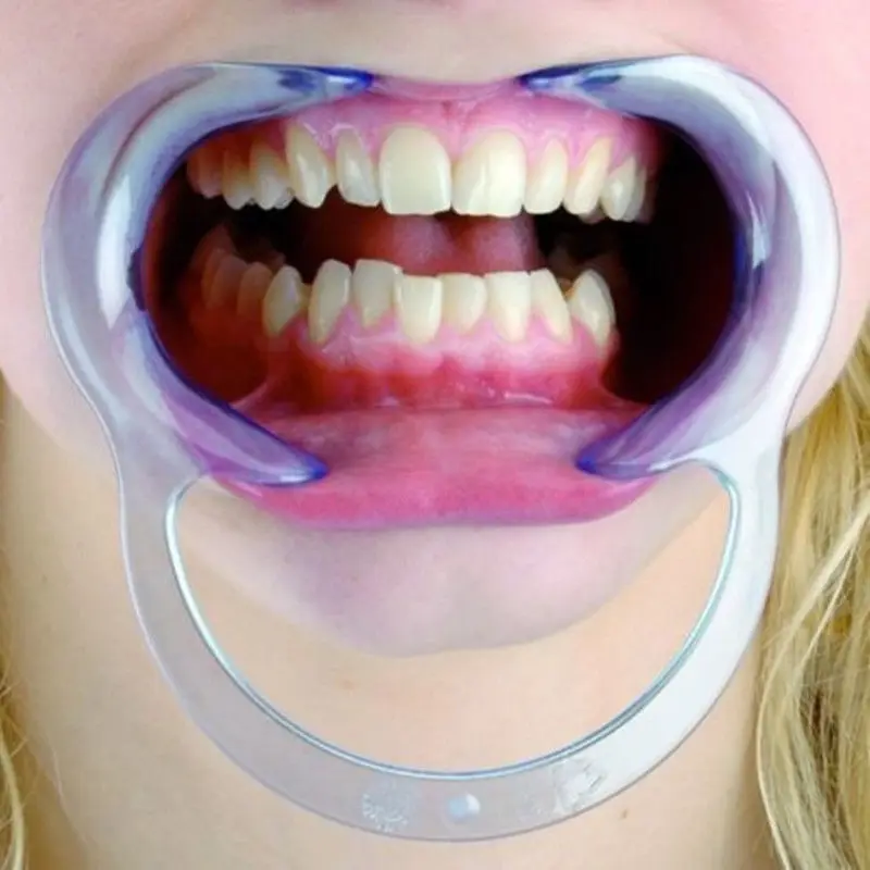 2 Pcs Mouth CShape Opener Dental Cheek Retractor Fun Game Watch Large size