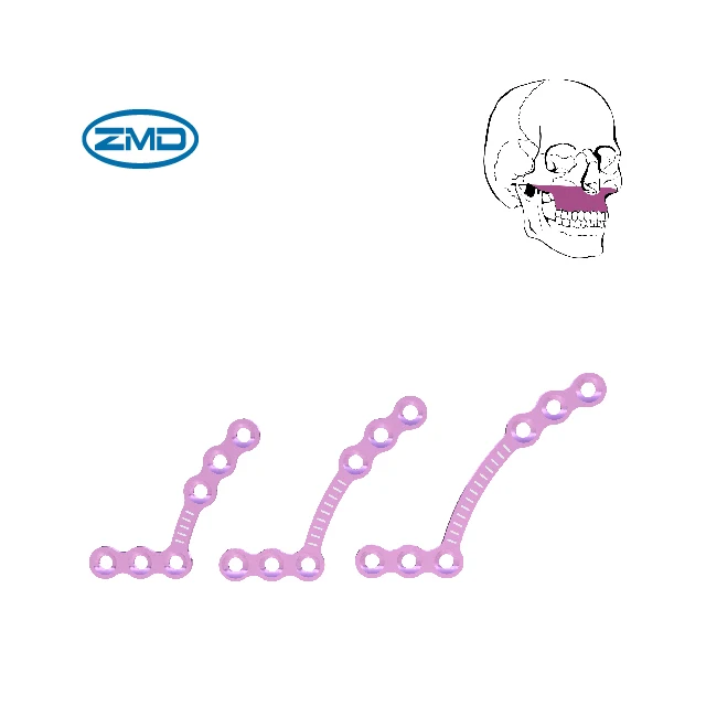 Orthopedic Maxillofacial 1.5 Self-drilling Screw