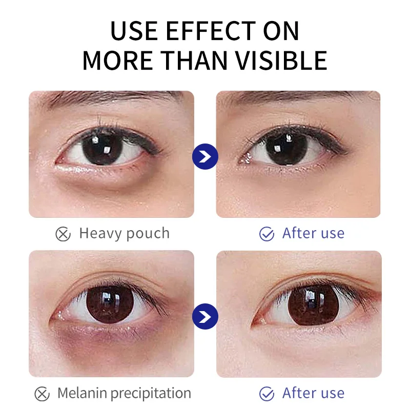 Custom Logo 15ml Snail Centella Under Eye Tightening Serum Lift Anti Wrinkles Anti Aging Collagen Peptide Eye Cream