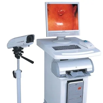 4D Color Colposcope Equipment with High-Clearness Screen Imaging Fast Working High Precise