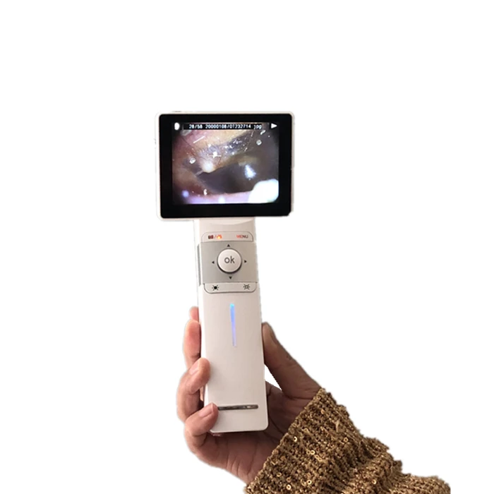 Ophthalmic Equipment Digital Otoscope Ophthalmoscope Dermatoscope Veterinary Video Otoscope