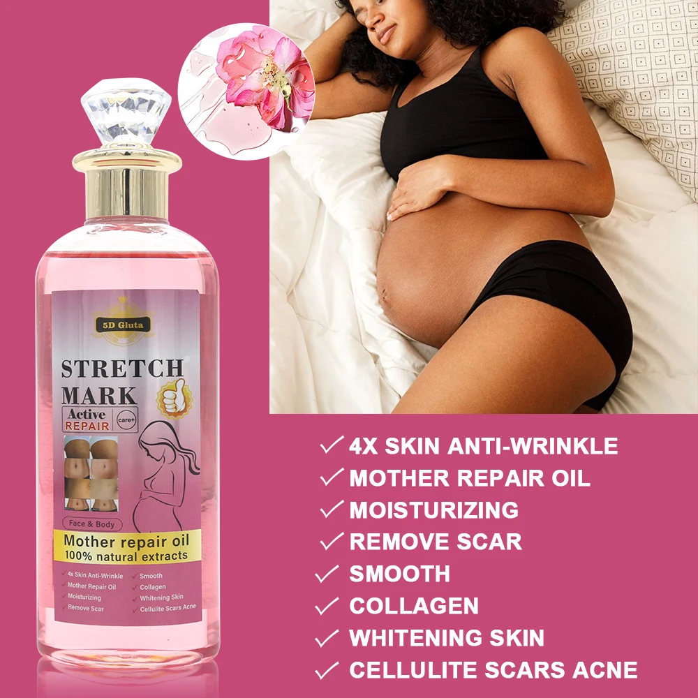 Natural Extracts Stretch Marks removal oil cream products Treatment Repair Scar Postpartum Repair Firming Body Stretch Marks Oil