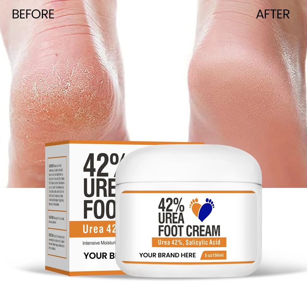 Best 42% Urea 2% Salicylic Acid Dry Cracked Heel Remover Urea Foot Cream Dead Skin Removal Cracked Heels Foot Cream
