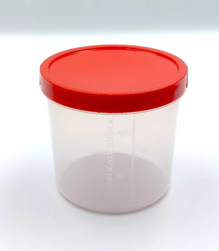 Disposable Spescimen plastic 100ml urine container with screw cap Container Urine test cup sterile specimen containers products