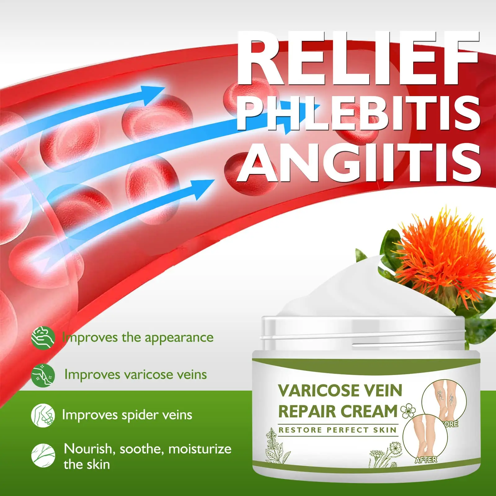 Amazon Best Seller Varicose Veins Cream to Relief Veins Pain and Heavy Tired Leg Spider Varicose Vein Treatment Cream For Legs