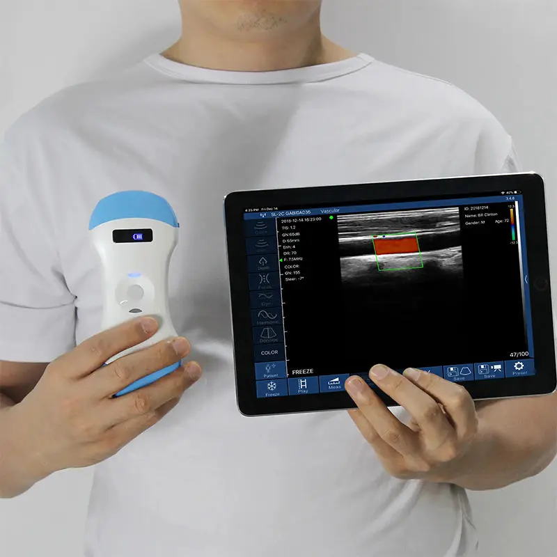 Clinical Application Diagnostic Handheld B Mode Probe 128 Elements Wifi Wireless Ultrasound Scanner For Human Being