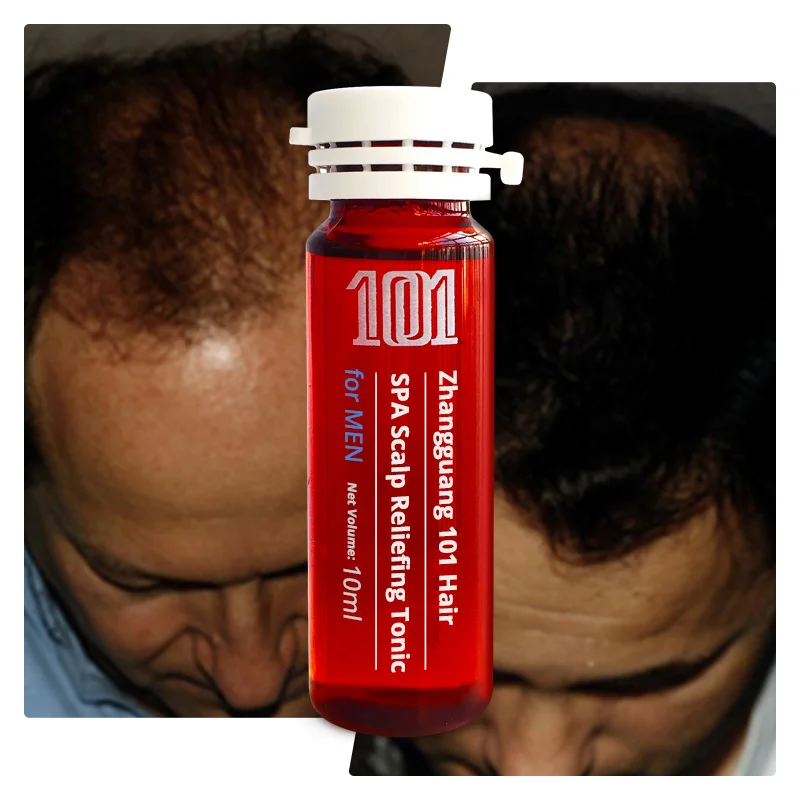 Wholesale Ginseng Extracts Hair Care Tonic Hair Growth Serum for men