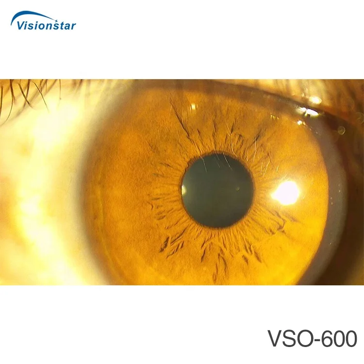 VSO-600 New Model Digital Portable Slit Lamp