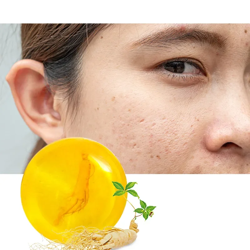 100 g Handmade Soap Ginseng Soap Herbal Oil Whitening Face Body Home Use Soap
