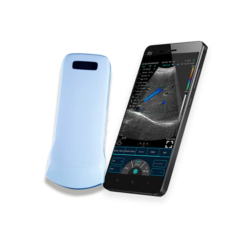 Hot hand held wireless medical ultrasound machine for Abdomen from Konted C10CT