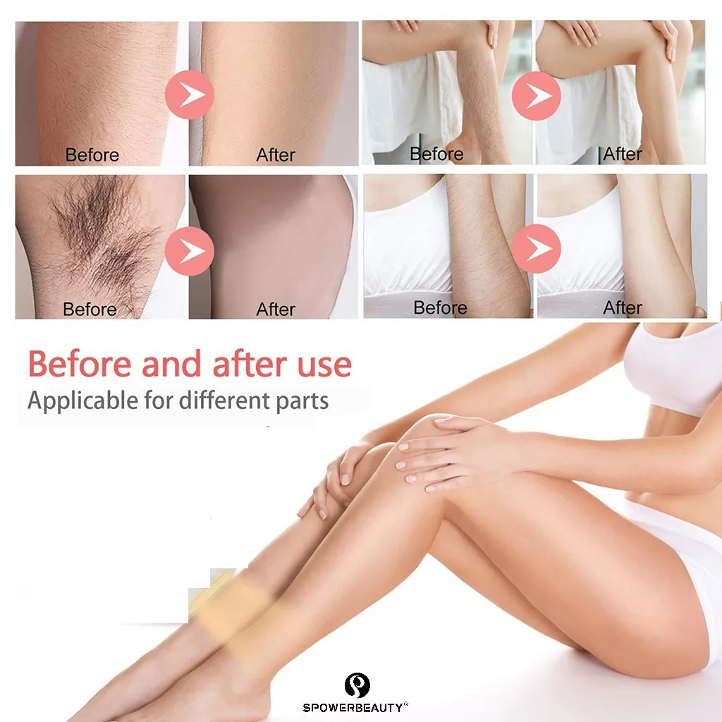 ipl hair removal zhu (10)