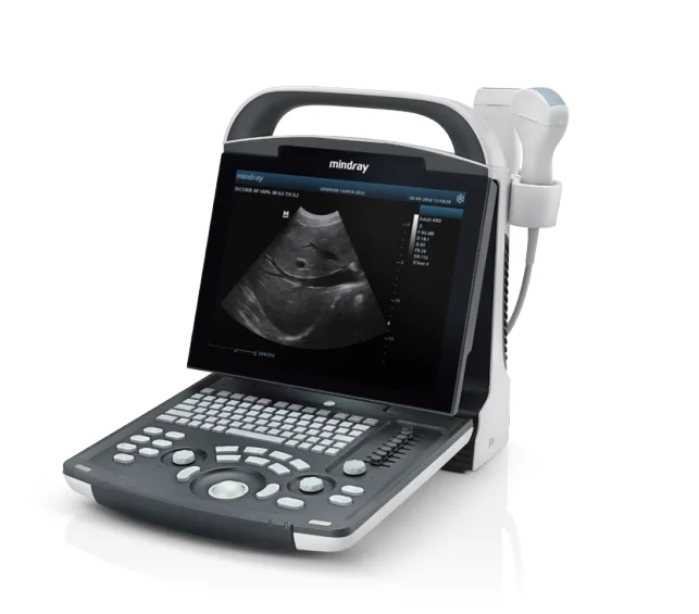 Medical DP-20 Popular Best B/W Ultrasound Scanner Ultrasound medical ultrasound instruments