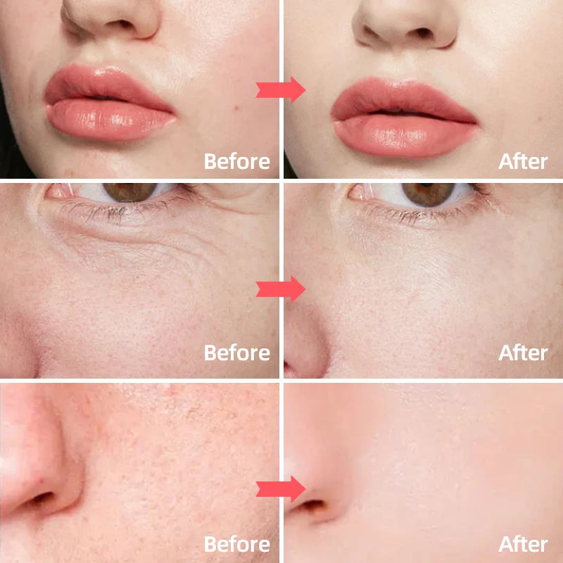 Anti Aging Wrinkle Night Face Moisturizer Skin Tightening Firming Face Cream With Hyaluronic Acid Retinol