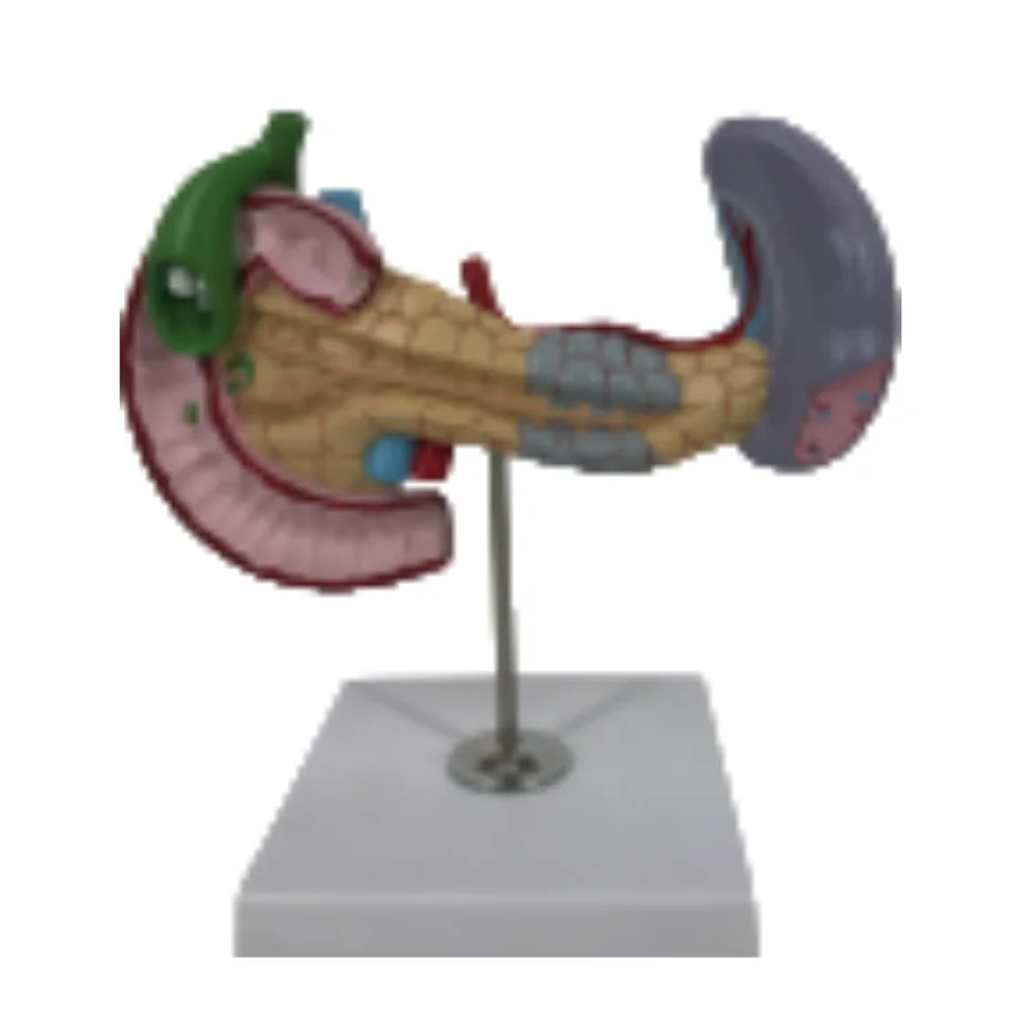 ADA  Pancreas, duodenum spleen models and Pancreatic bile duct pathological model with Pancreatic bile duct pathological model