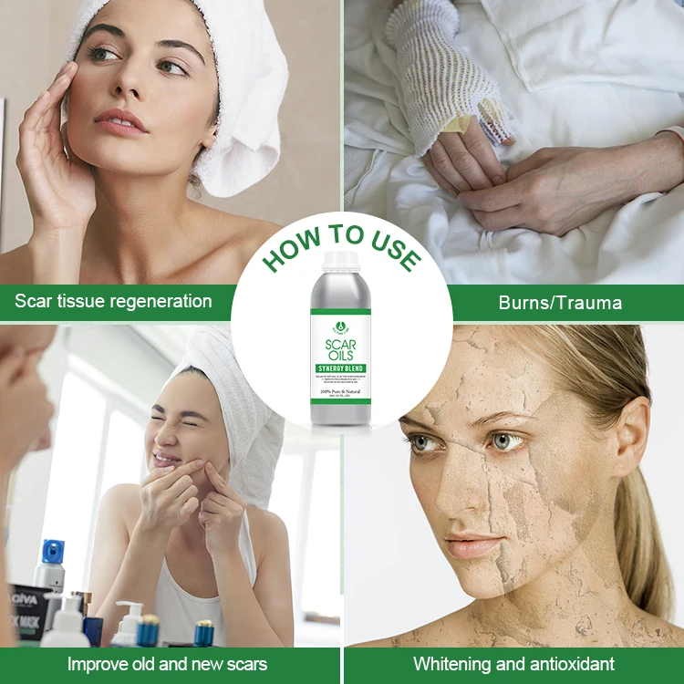 Alltimecare Body Works Fragrance Edible Body Shimmer Oil No Logo Scar Moisturizing Body Oil