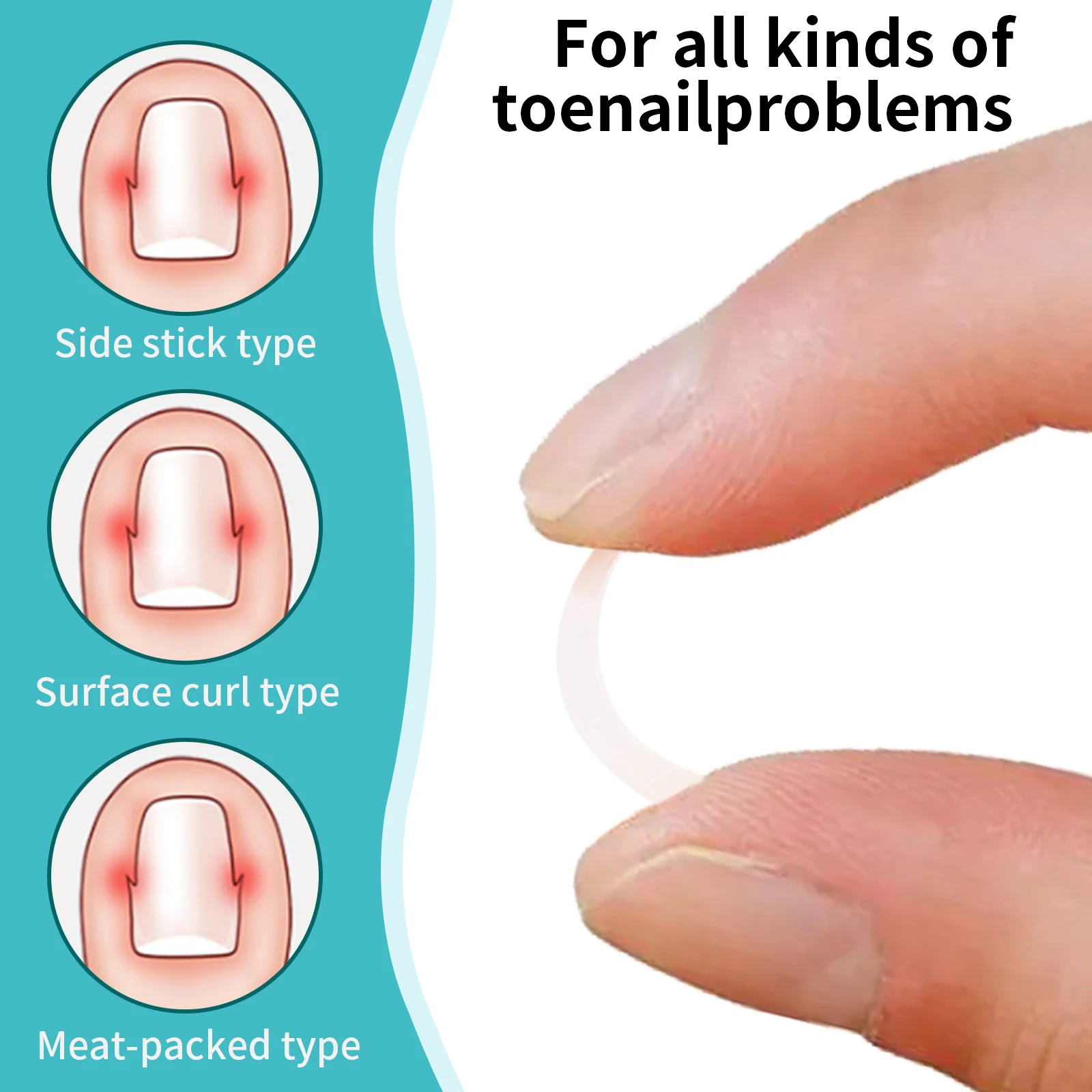 10pcs Epoxy Board Material Transparent Ingrown Toenail Correction Tool Pedicure Tools Foot Care Toe Nail corrector