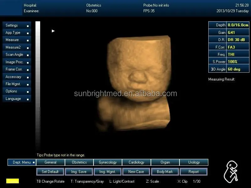 SUN-800D Manufacturer Hospital device Ultrasound Machine 3D diagnostic Scanner ecografo portatil Laptop BW Vet ultrasound