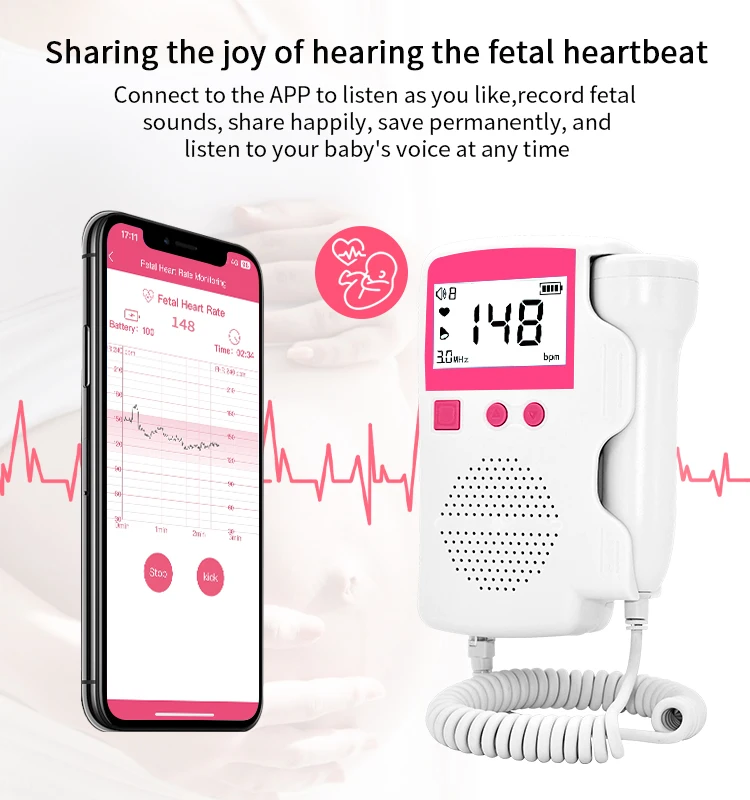 Mini Handheld Fetal Doppler CE certified Monitor Baby Heart Beat Doppler App Record Heart Rate