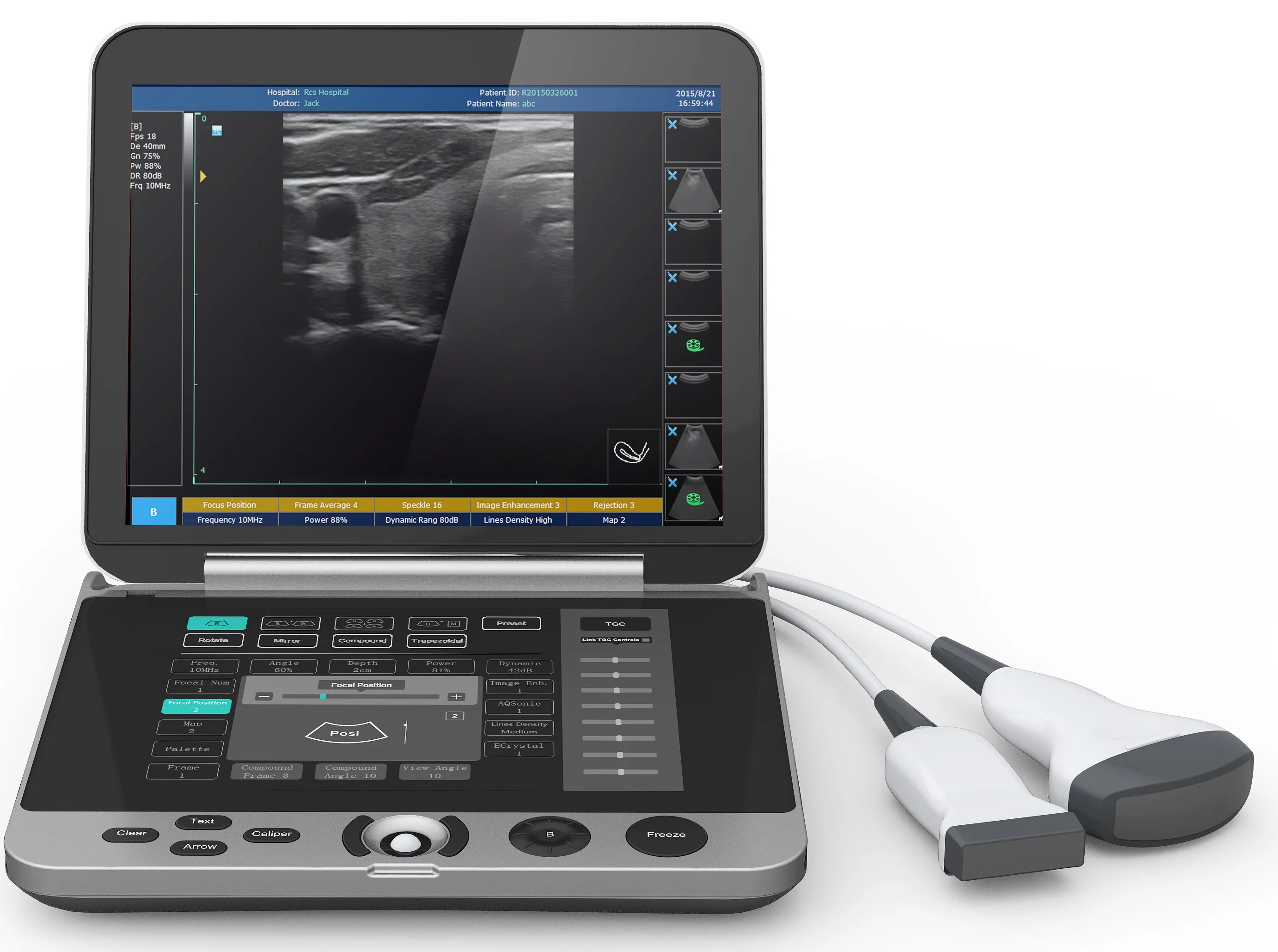 High resolution  laptop B/W ultrasound MSK  ultrasound scanner  laptop ultrasound machine